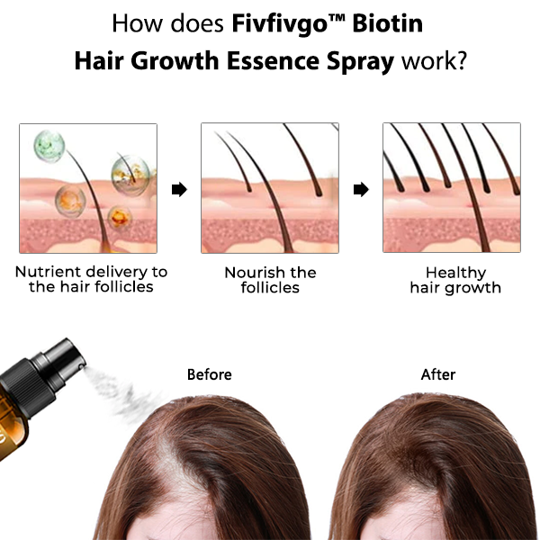 Biotin Hair growth Essence Spray