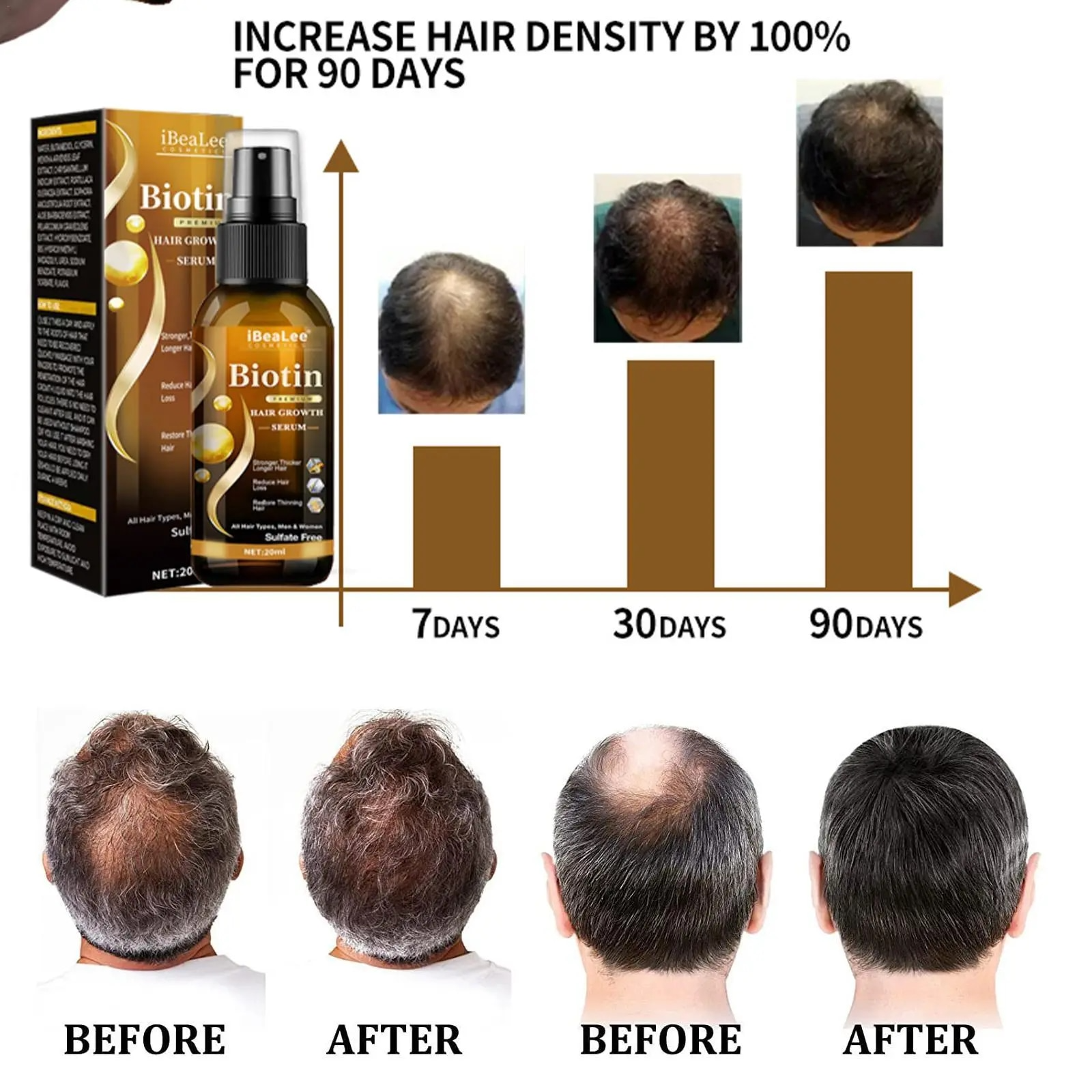 VitaMane™ Biotin Hair Growth Spray (t/m Deze Week: 1+1 GRATIS)